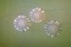 Actinomyces_spp_01
