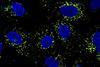 Low-Res_Dengue infected cells