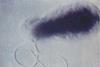 Bartonella