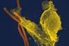Neutrophil_with_anthrax_copy