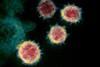 Novel_Coronavirus_SARS-CoV-2