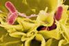 Salmonella invasion in immune cell