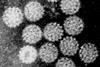 Papilloma_Virus_(HPV)_EM_(new_version)