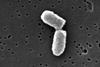 Ecoli_dividing