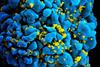 HIV-infected_T_cell_(6813384933)