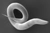 Electron_micrograph_of_''Caenorhabditis_elegans''