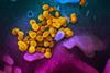 SARS-CoV-2_(yellow)