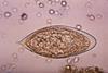 Schistosoma_haematobium_egg_4843_lores