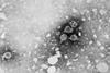 Hepatitis_B_virus_01