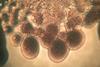 Beautiful_Bacillus_subtilis_bacterial_growth_under_the_microscope_06