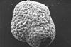 Foraminifera-diagenetic-altered_hg