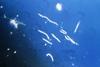 Borrelia_burgdorferi_(CDC-PHIL_-6631)_lores