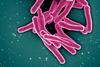Mycobacterium_Tuberculosis_Bacteria,_the_Cause_of_TB_(52766234986)