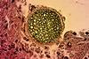 Coccidioides_fungal_spherule_found_in_a_tissue_sample_of_this_organism_that_causes_coccidioidomycosis,_also_known_as_Valley_Fever