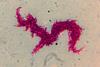 Classic_serpentine_cording_of_Mycobacterium_tuberculosis_complex_(MTBC)