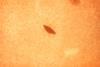 lossy-page1-800px-Streptococcus_salivarius.tif