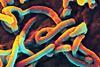 Ebola_Virus_(5)