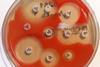 Serratia_marcescens_-_antibiogram