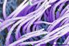 Influenza_A_virions_on_cilia_human_nasal_epithelium_SEM_high_magnification