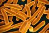 640px-E._coli_Bacteria_(16598492368)