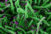 Novel_Coronavirus_SARS-Cov-2_(50010217143)