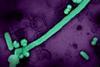 Influenza_A_Virus_(H3N2)