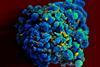HIV-infected_H9_T_cell