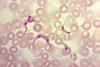 T._cruzi_trypomastigotes_in_peripheral_blood_smear