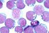800px-Epstein-barr_virus_(ebv) (1)