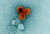 Epstein-Barr_Virus_(EBV)_Particles