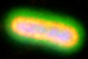 Low-Res_Klebsiella pneumoniae