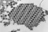 Chikungunya_virus_particles-PHIL-17369