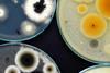 Low-Res_bacteria in a petri dish