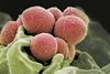 Streptococcus pyogenes (Group A Strep)