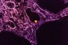 West_Nile_Virus_Particle
