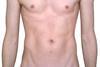 Male_chest_abdomen_anatomy