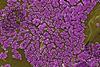 Methicillin-resistant_Staphylococcus_aureus_10047