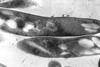 800px-Mycobacterium_tuberculosis_01