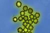 H1N1_Influenza_Virus_Particles_(8411599236)