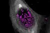 Low-Res_Human cell infected with Chlamydia janas