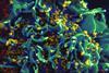 national-institute-of-allergy-and-infectious-diseases-izdPjeTiFL0-unsplash (1)