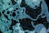 Yellow_fever_virus