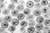 TEM image of HIV-1