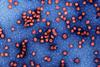 Hepatitis_b