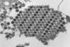 Chikungunya_virus_particles-PHIL-17369