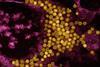 Enterovirus_D68_Virus_particles_colorized_transmission_electron_micrograph_-_211
