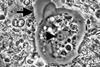 Parasite130116-1-olm_Entamoeba_gingivalis_microscopy.tif