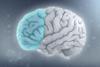 Attention_deficit_hyperactivity_disorder_-_Attention_deficit_hyperactivity_disorder_-_Reduced_brain_volume_on_the_left_side_from_ADHD