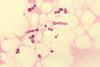 Malassezia_furfur_in_skin_scale_from_a_patient_with_tinea_versicolor_PHIL_3938_lores