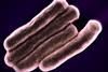 Mycobacterium_Tuberculosis_Bacteria,_the_Cause_of_TB_(52766722758)